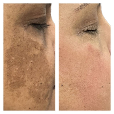 Why Your Skin Treatments Aren’t Working (And What To Do Instead)