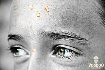 Hyponatremia: The Hidden Danger of Sweating Out Your Salt