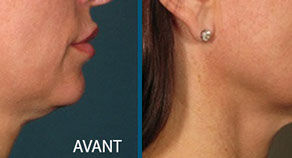 Centre esthétique aquitaine pour le visage le cou le décolleté