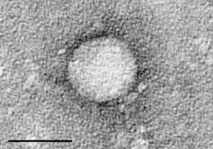 Why is Hepatitis C Tripling?