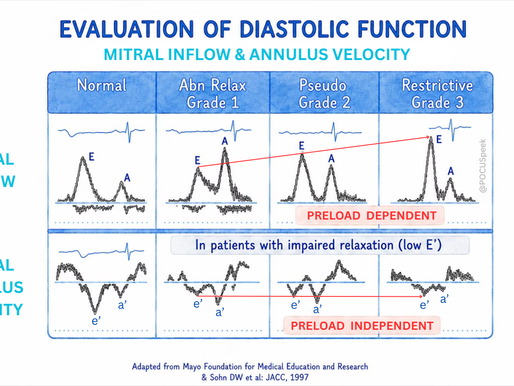 Evaluation of Diastolic Dysfunction