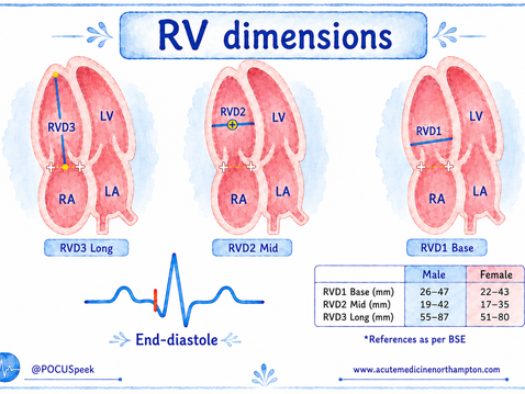 Right Ventricular Dimensions