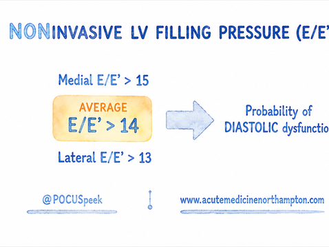 Left Ventricular Filling Pressure