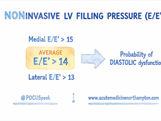 Left Ventricular Filling Pressure