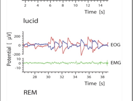 Lucid Dreaming… how does it work?