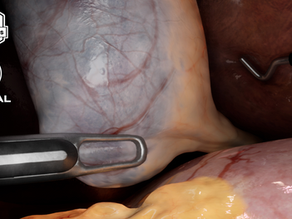 Next level Robotic Surgical Simulation