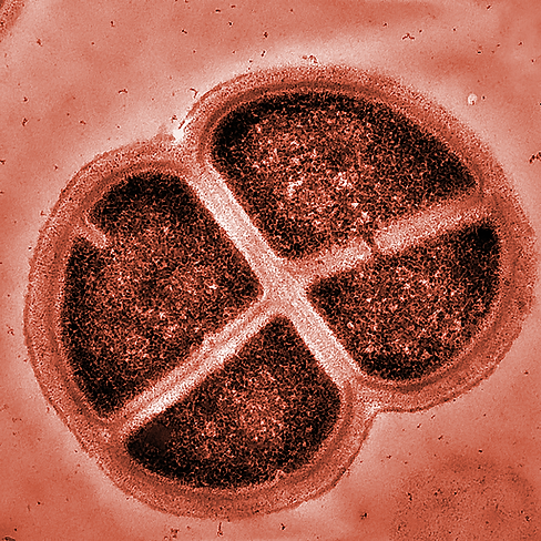 Deinococcus-Radiodurans_Alice-Dohnalkova_EMSL-e1648325544689-2160x2160.png