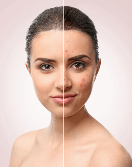 Skin Lightening Treatment in Jayanagar – Skinxperts
