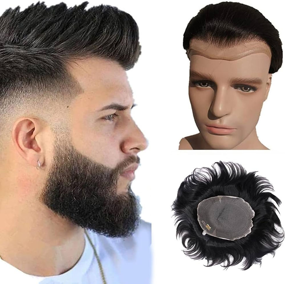 Best Non-Surgical Hair Replacement in Bengaluru – Flair Hair Fixing