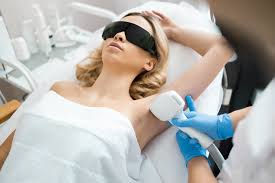 Underarm Laser Hair Removal in Jayanagar – Skin Xperts