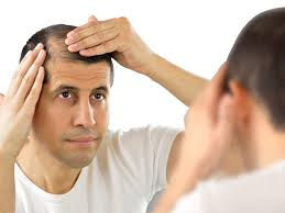 Hair Regrowth Treatment in Jayanagar – Skinxperts