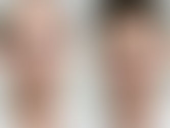 Non-Surgical Hair Fixing in HSR Layout – Flair Hair Fixing