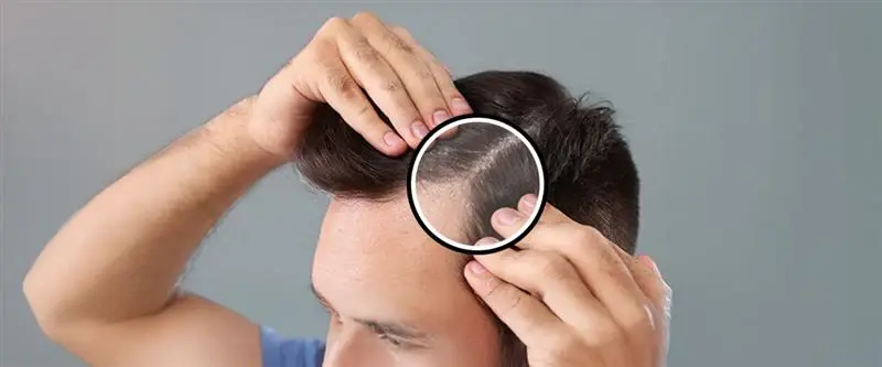 Hair Thinning Treatment near Jayanagar - Skinxperts