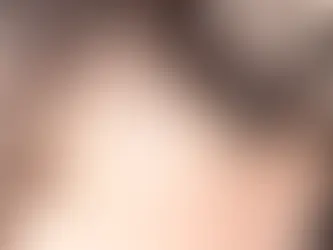 Hair Thinning Treatment near Jayanagar - Skinxperts