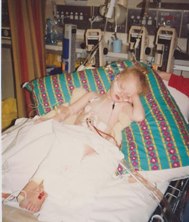 Open Heart Surgery Fontan CHD HeartKids
