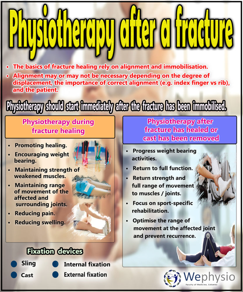 Physiotherapy after a fracture?