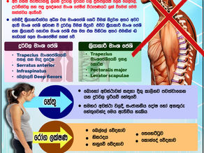 UPPER CROSSED SYNDROME (UCS)