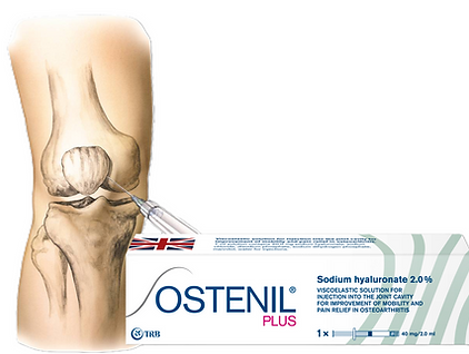 Website - Knee Injection with Ostenil Plus12.png