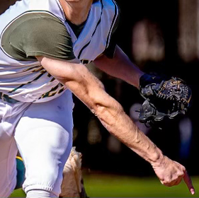 An Athlete Injuring Their Arm While Playing Their Sport