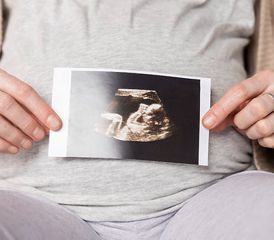 woman displays her ultrasound image, capturing a moment of happiness as she prepares for motherhood.