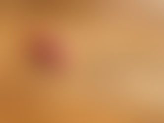 Share the Story of Your Scars