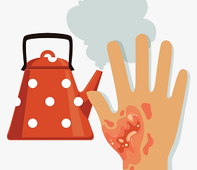 skin burn clipart