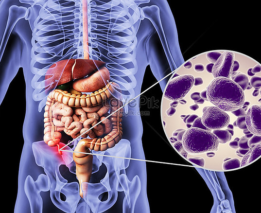 Appendicitis Treatment in Rajahmundry