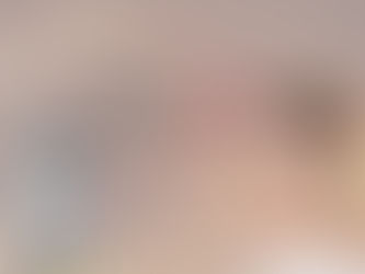 Diolight I : เทคโนโลยี Diode Laser เพื่อการกำจัดขนอย่างปลอดภัย