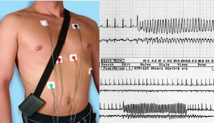 holter-ekg.jpg