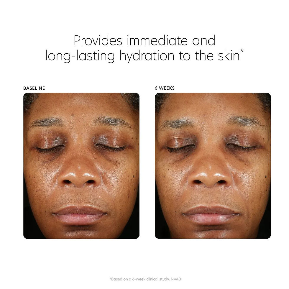 Thumbnail: Hyaluronic Acid Boosting Serum