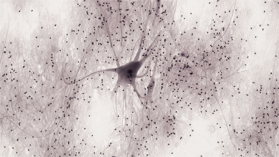 A neuron