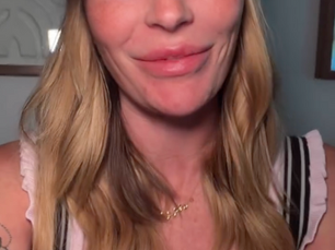 Healthy Skin > Perfect Skin