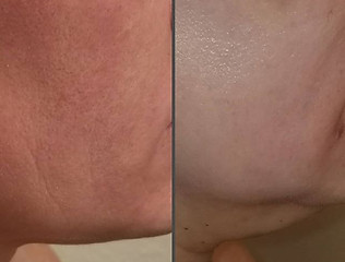 Best Botox Globe AZ