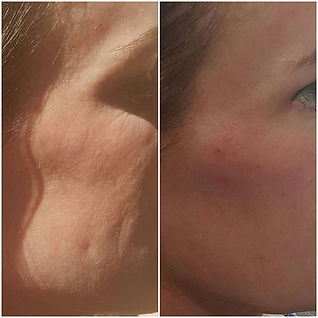 Best Botox Near Me