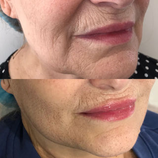 Plasma.B&A.1.Mouth.jpeg