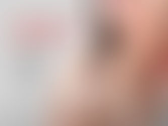 Caroços, febre e cansaço: conheça sinais do linfoma