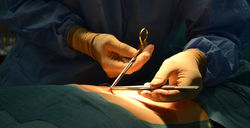 illustration_operation