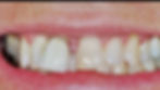 Digital smile analysis