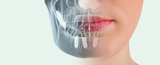 Su mejor opción en Odontología Integral / Get the best help from Your Dentist