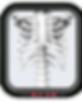 rib cage