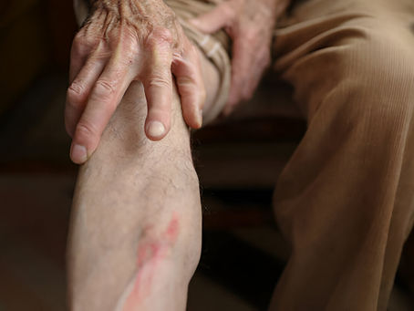 Understanding the Risk of Blood Clots in Seniors and How to Prevent Them