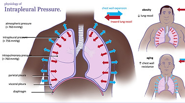 Diagram of intrapleural pressure showing opposing forces of lung recoil and chest wall expansion, with pressure values