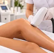 Illustration d’une séance d’épilation laser sur une jambe.
