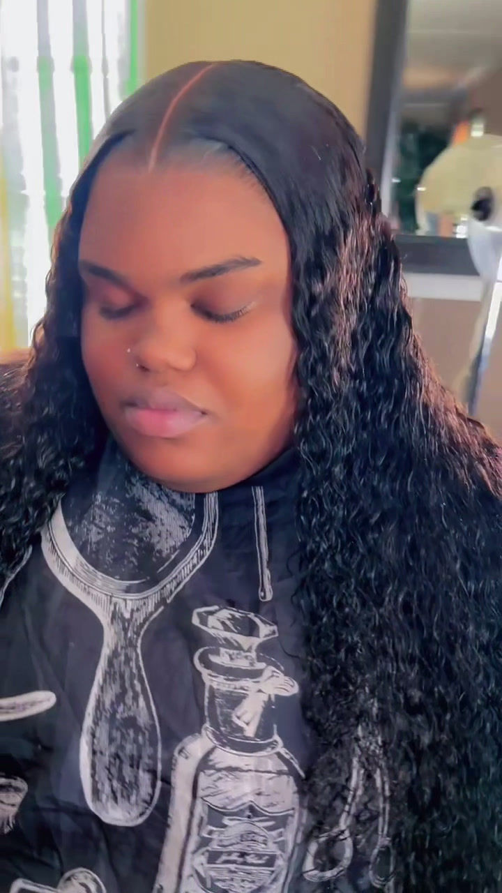 Thumbnail: Frontal Install