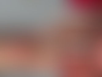 The Operation.  Videos 1&2 Inside.