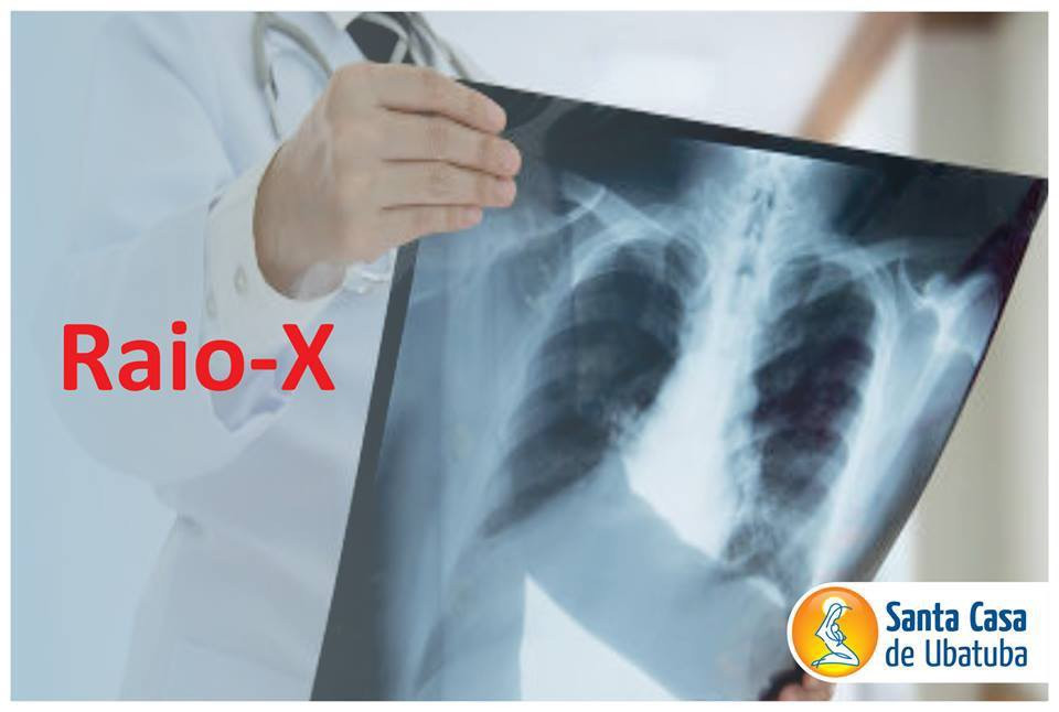 Mão de médico segurando um raio x
