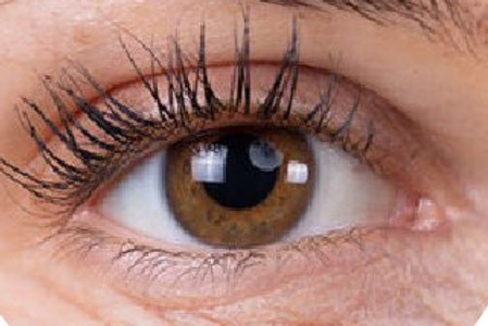 Cosmetic Eye Surgery