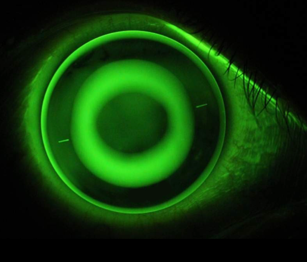 Screenshot 2024-11-26 073843.png