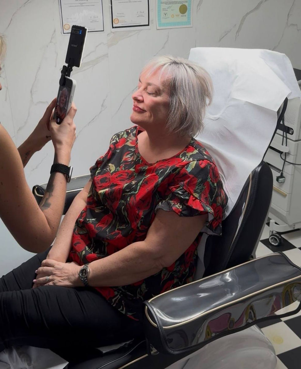 Tina taking after photos of a client’s treatment results in clinic