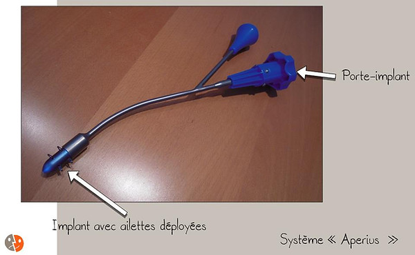 Aperius: Porte-implant
